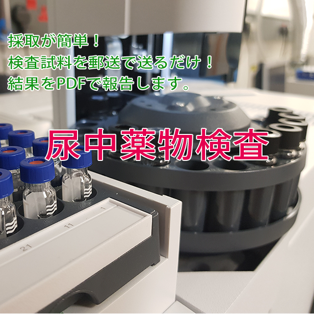 【薬物検査】尿中薬物検査（危険ドラッグ）