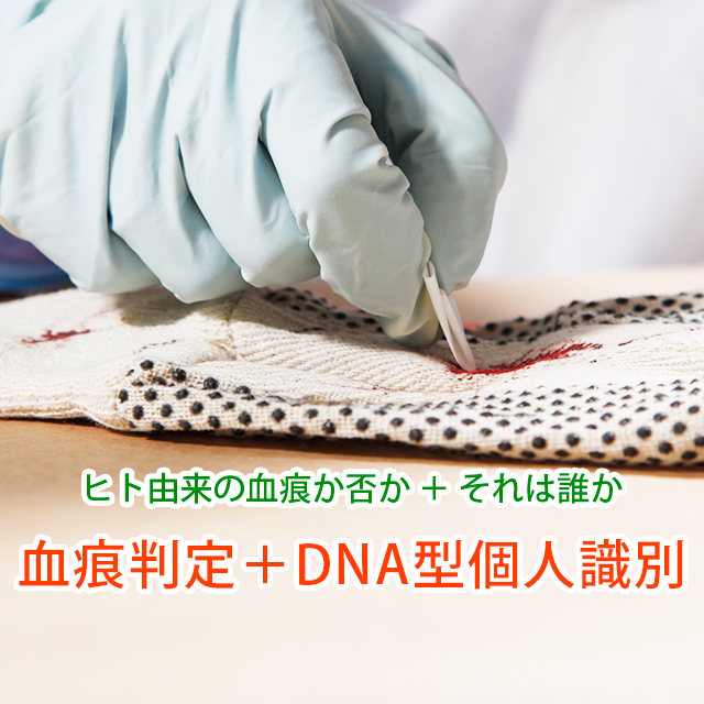 【特急対応】血痕判定＋DNA型個人識別